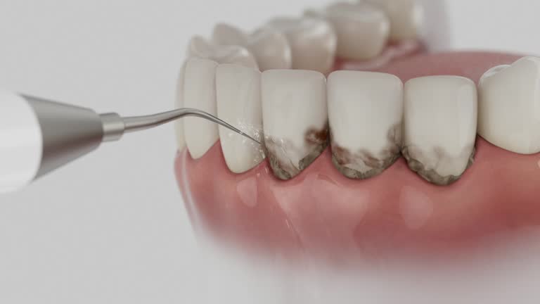 Trusted Root Canal Treatment service in Blue Mound, TX - Dentist Open Now